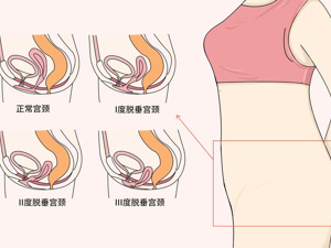 双子宫大小接近