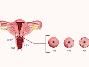 外阴营养不良