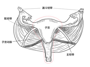 不完全子宫纵隔