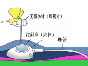 缫