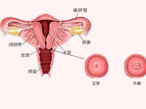 孕妇_子宫内停止发育