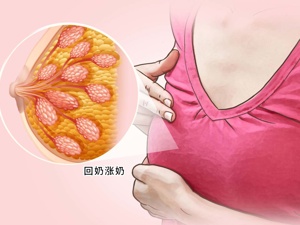 催乳素水平短暂上升