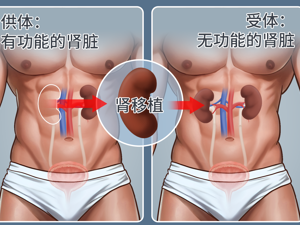 患者_器官功能衰竭