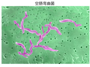 空肠弯曲菌肠炎