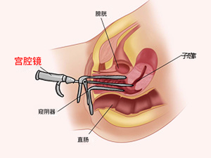 女性_妇科检查