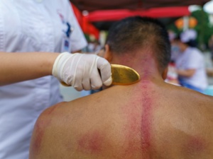 行业聚焦！南京太乙堂中医院中医来助力“实用妙招”膀胱癌化疗副作用缓解