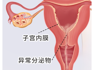 今日动态：郑州子宫内膜薄“精选 ”郑州看子宫内膜薄医院