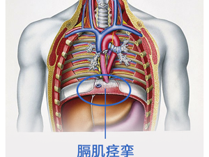 患者_胃部气体积聚并刺激膈肌