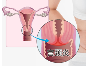 九江hpv比较好的医院排行榜发布-九江哪家医院看hpv效果好名单公开-线上预约