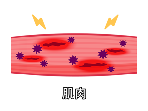 肌肉酸痛
