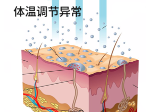 体温调节异常