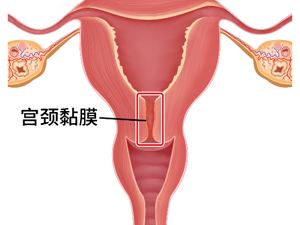 义乌治疗宫颈肥大的好医院“排名公布”义乌看宫颈肥大医院推荐