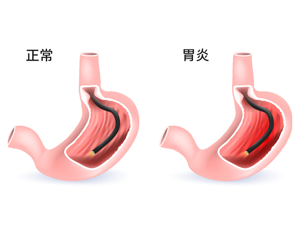 榜上有名：北京治疗胃病去哪家医院-胃酸过多可以吃什么