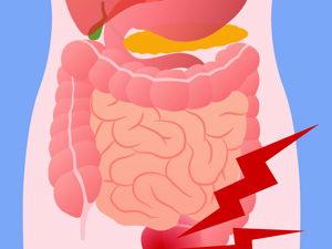 急性阑尾炎腹胀不排气