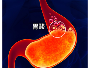 胃酸过多