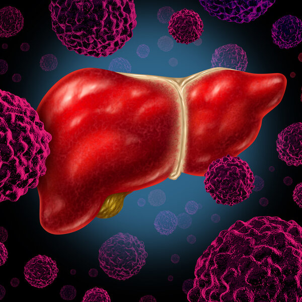 肝恶性肿瘤和肝癌是一回事吗