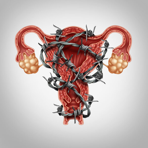 NEJM：乐伐替尼加派姆单抗治疗晚期子宫内膜癌