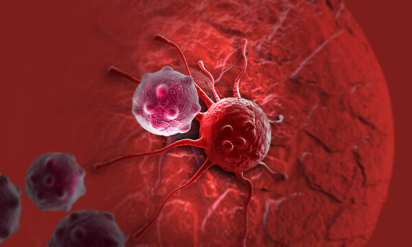 Cell Metab：“饿死”肿瘤的想法真的可实现了？科学家发现模拟禁食饮食可以阻止三阴性乳腺癌和癌症干细胞逃逸！