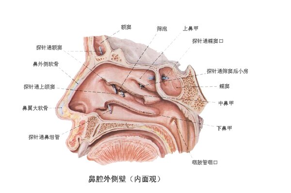 鼻中隔肿了疼怎么回事