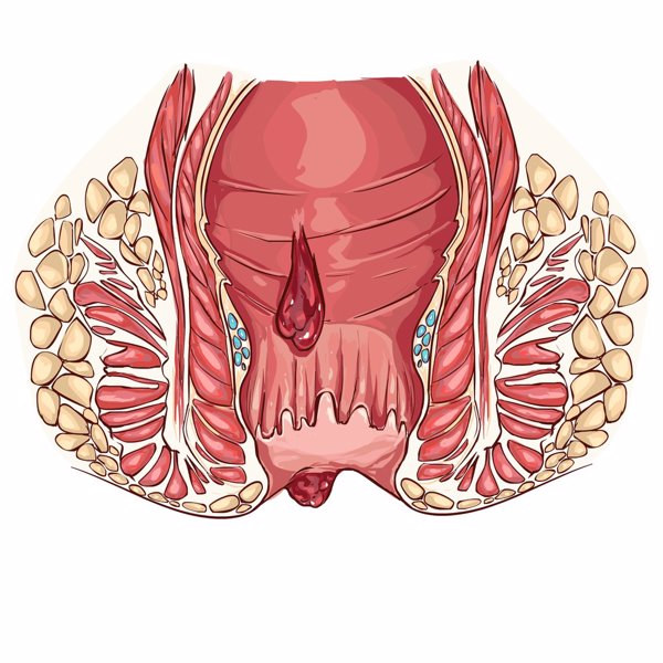 大便困难肛门疼痛肿胀