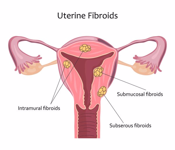 分泌物呈绿色豆腐渣状是怎么回事女性