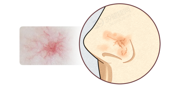 如何知道自己肝损伤没有