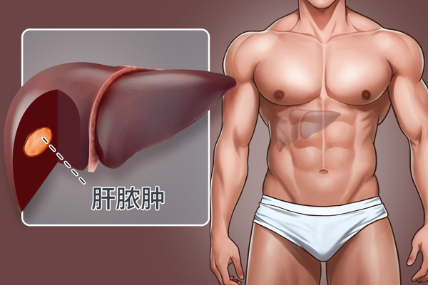 肝脓肿最佳治疗方法