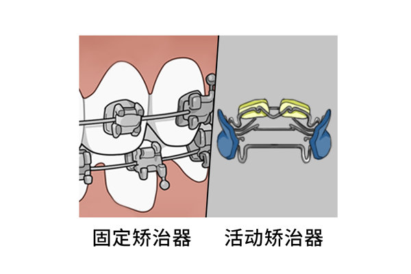 呼吸中止症怎么治疗