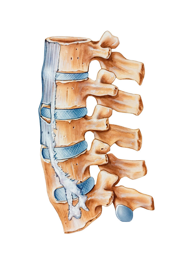 腰椎间盘突出 体征