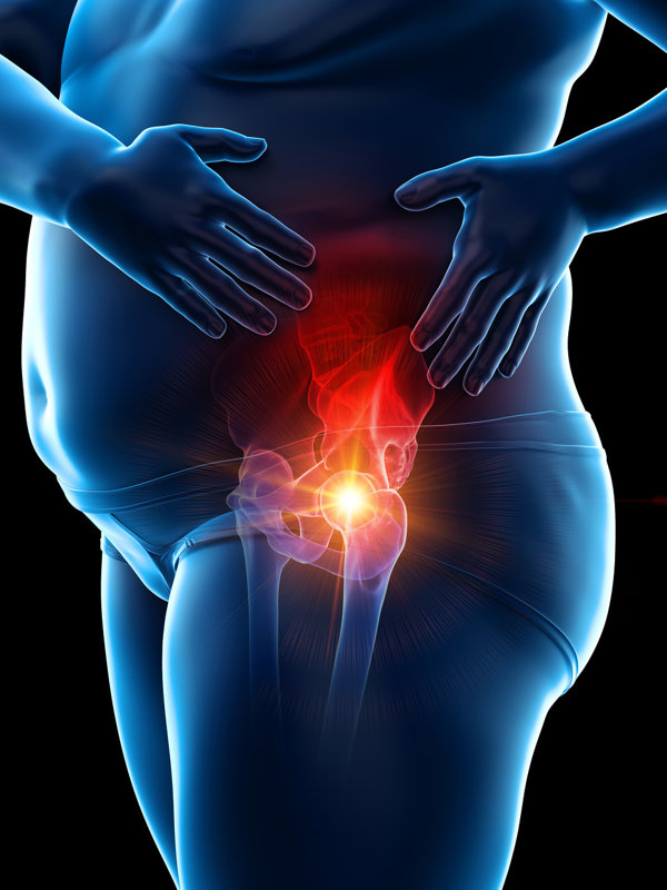 广州治疗继发性肥胖的正规医院哪家好