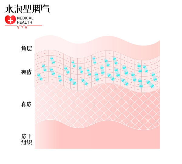 怀孕宫腔内可见不规则液性暗区看不到 孕囊