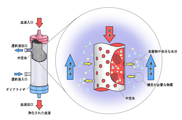 透析溶血的原因有哪些