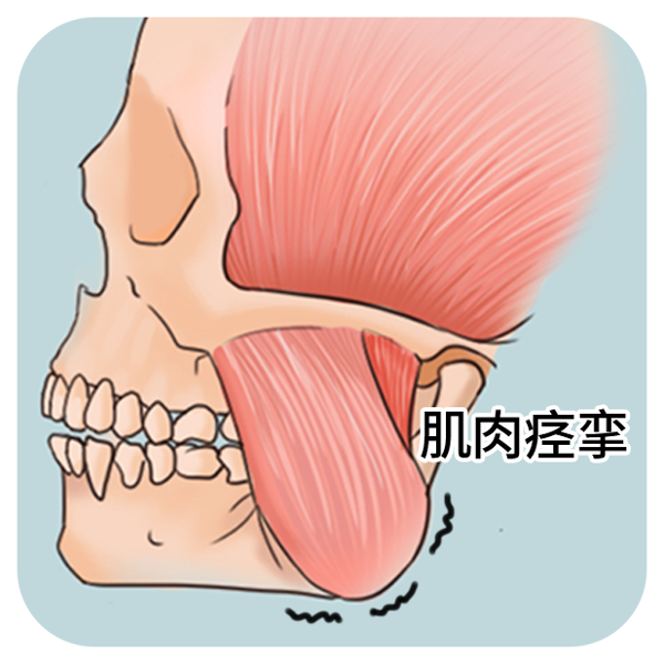 下颌后缩有什么影响