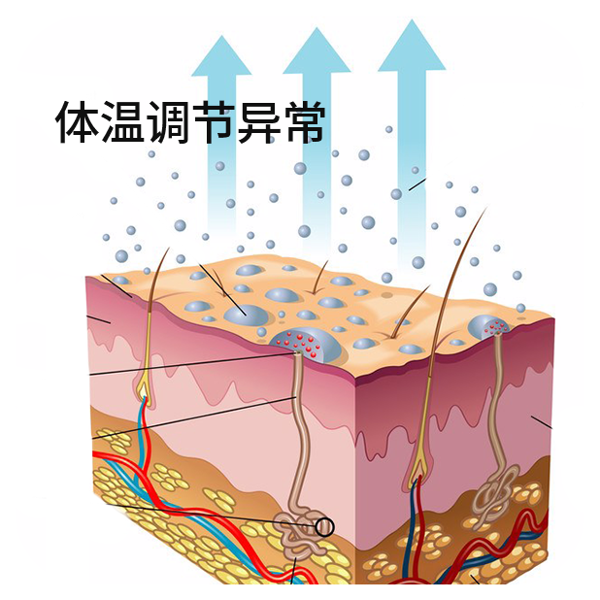 白癜风温热治疗