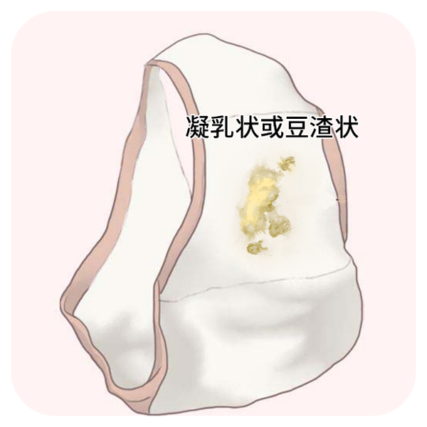 乳白色分泌物是要来月经了吗