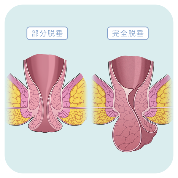 四川治疗包皮过长的医院