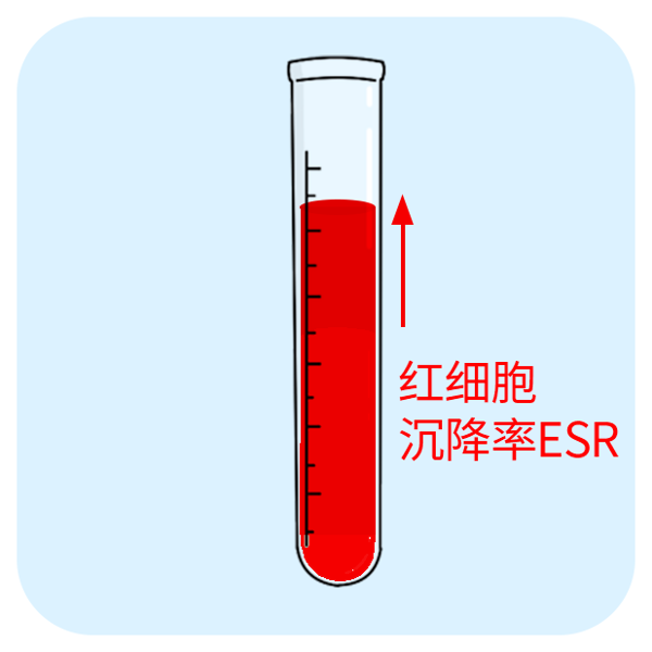 新生儿rh血型不合溶血病