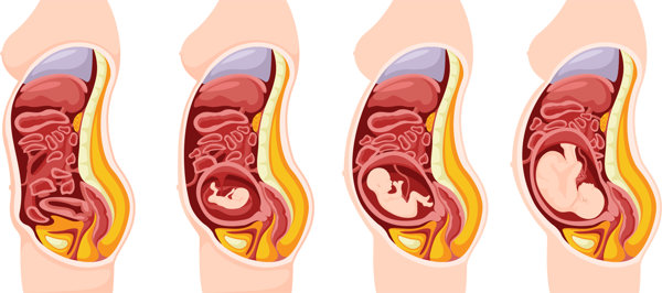 子宫纵隔可以怀孕生孩子吗有危险吗