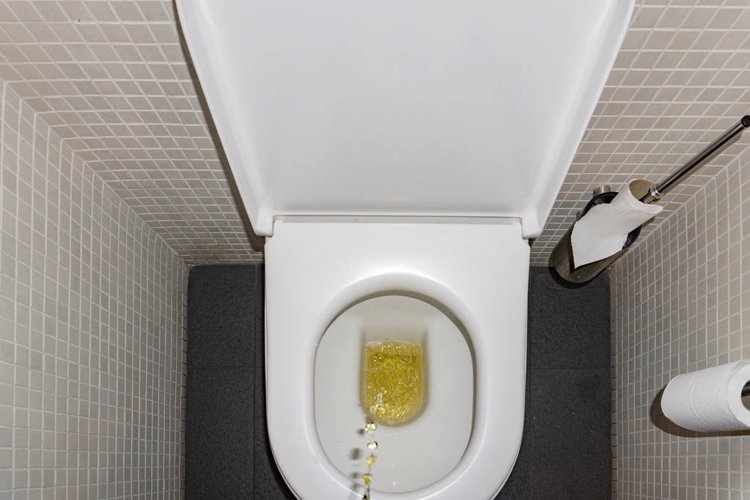 身体有病,排尿先知?出现5种排尿异常,当心“麻烦”找上门