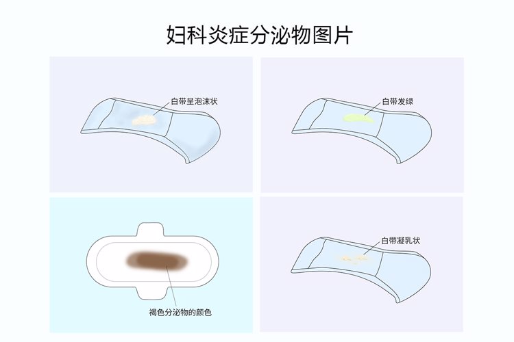 裤子脱掉腿张开！医院内让人脸红的“妇科检查”，怎样做才不会错