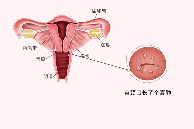 如果没有性生活，得宫颈癌的风险会降低？有没有科学道理？