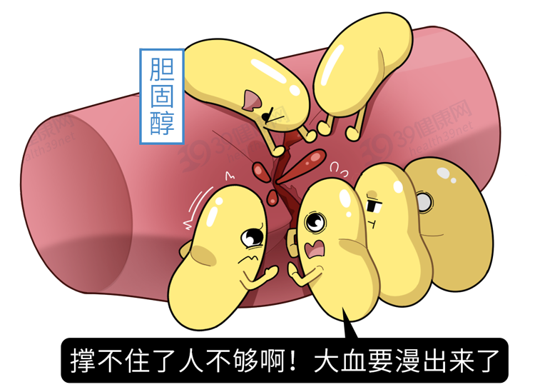 上海瑞金研究：胆固醇越低，癌症风险越高，真的吗？告诉你答案