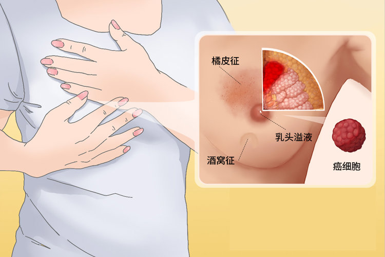 单身男士的疑问：为啥有些女生胸部柔软像面包，有些却硬得像馒头