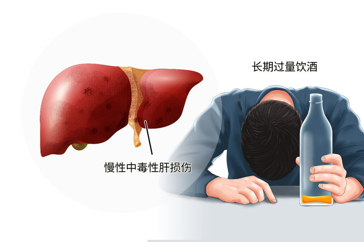 喝酒真的不能吃花生米吗？忠告喝酒的人：3种食物尽量别做下酒菜插图2