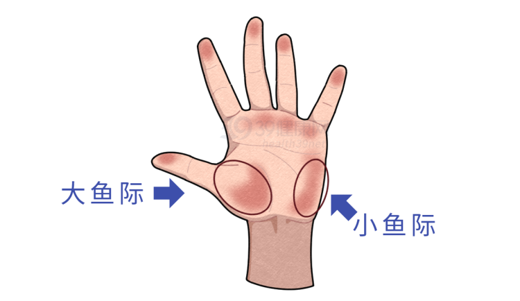 11岁男孩吃出重度肝硬化！这3个“好习惯”，或是伤害孩子的凶手