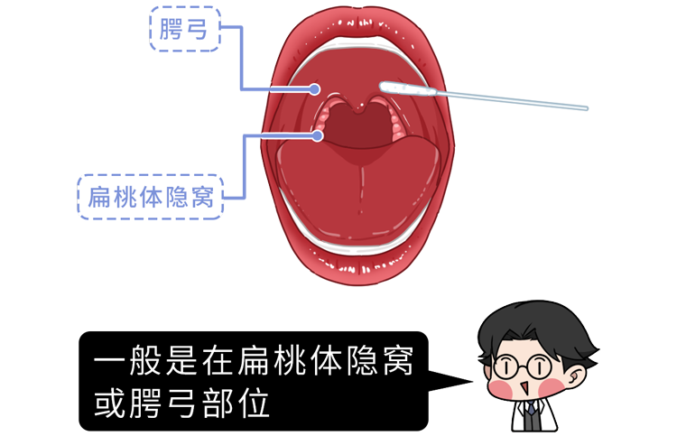 别把癌症当成了上火，医生提醒：出现5个症状，可能是癌症的预警