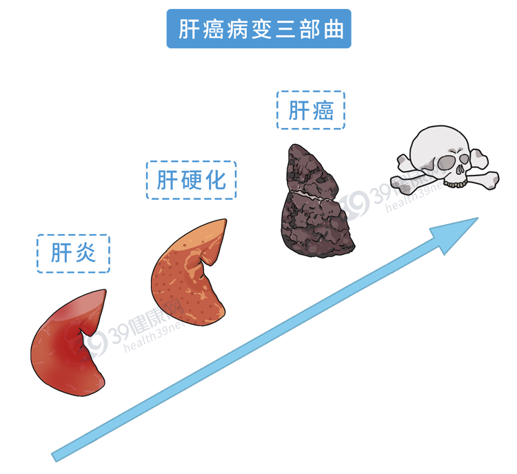 炎症是癌症的“催化剂”?3类食物或会加速炎症,尽早撤下餐桌