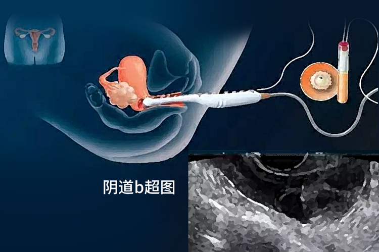 裤子脱掉腿张开！医院内让人脸红的“妇科检查”，怎样做才不会错