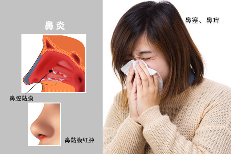 淇楄瘽璇粹€滅敺浜烘棤姣涜吹濡傞噾锛屽コ浜烘湁姣涙贩鍗婅鈥濓紝涓哄暐鏈変簺鐢锋€т笉闀挎瘺