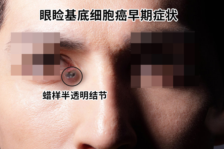 你的“福相”，可能是大病信号！面部出现5个“怪象”，尽早检查